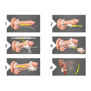 Shots – Penis Extender